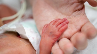 Uno de cada 10 bebés que nacen es prematuro