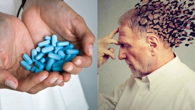 Un estudio confirmó que el Viagra reduce el riesgo de Alzheimer