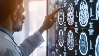 Implante cerebral con IA permite a paciente sin habla comunicarse en dos idiomas