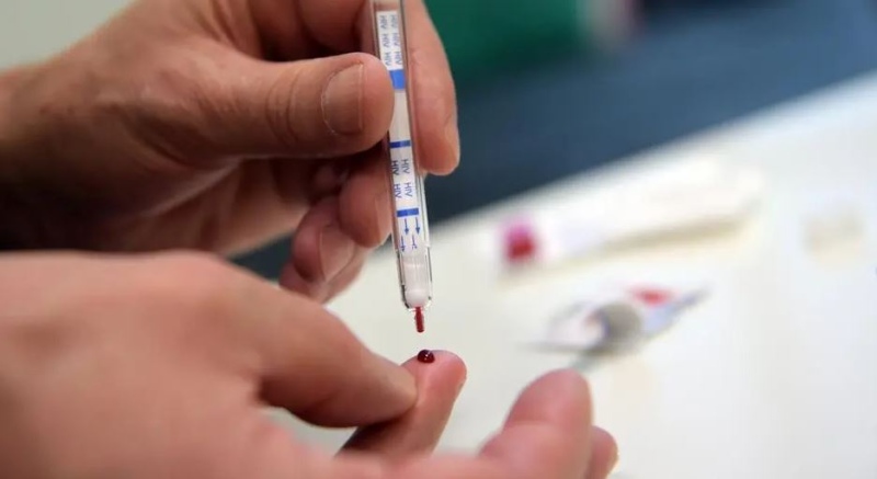 HIV: ¿cuándo es ”La noche de los testeos”?