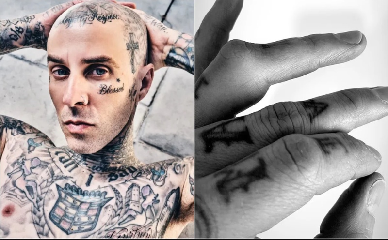 Travis Barker, baterista de Blink 182, se opera de la lesión en su mano izquierda