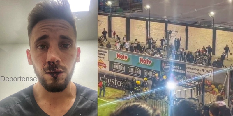 Un futbolista de Platense fue a ver a su amigo y los hinchas le rompieron la nariz