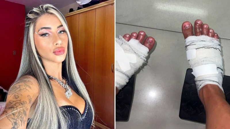 Tres influencers brasileños casi pierden los pies en un peligroso reto